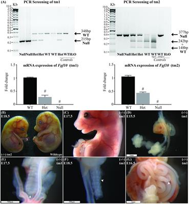 FGF10 and the Mystery of Duodenal Atresia in Humans